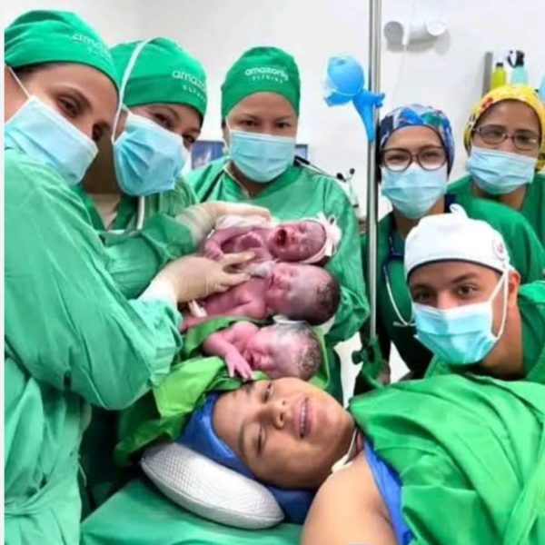 Guasipati registra el primer nacimiento de trillizos en su historia local